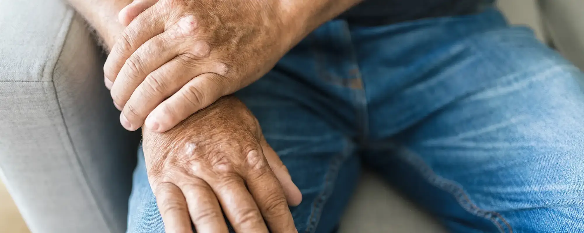 arthritis